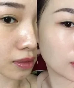 kem chong nang Martiderm 7
