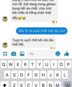 kem tri nut got chan SCHOLL 2