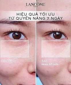 Kem mat Lanceme Renergie Yeux mini 3